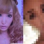 【衝撃変化】浜崎あゆみに憧れ整形を繰り返したキャバ嬢…。衝撃の変化と稼いだ額がヤバい!!